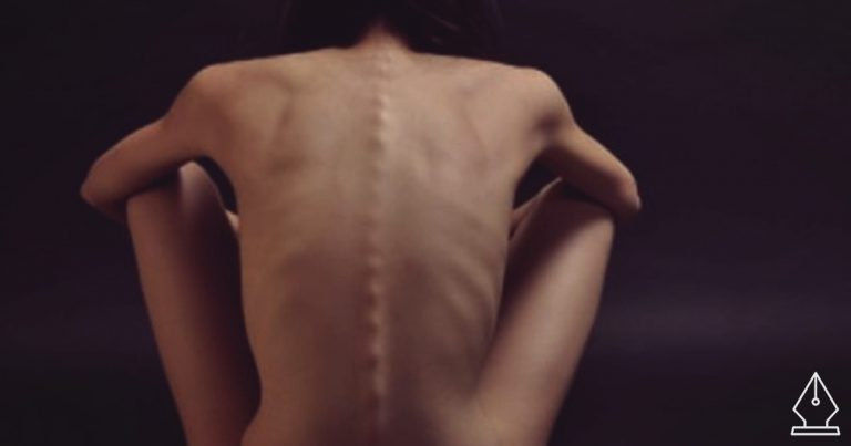 Anorexia testközelből – egy fiatal lány őszinte vallomása a betegségről és a hazug valóságról